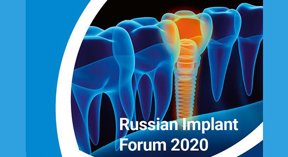 Russian Implant Forum